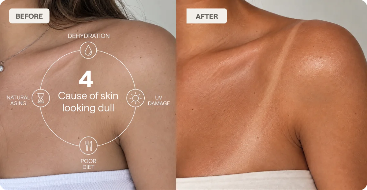 Before and after on the shoulder: four causes of dull-looking skin, then a warm even tone